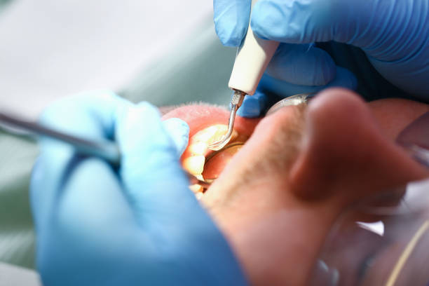 Best Urgent Dental Care for Toothache in New California, OH