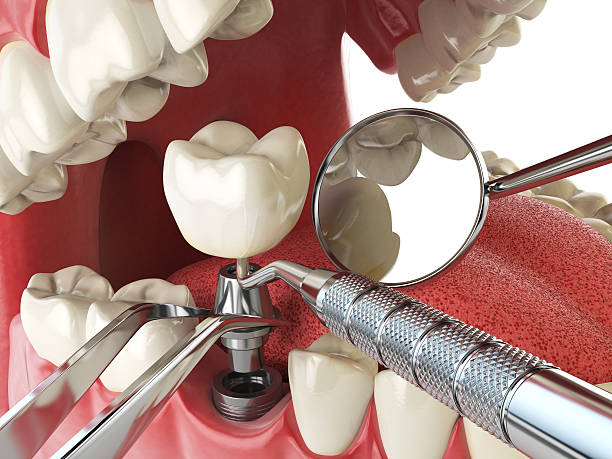 Best Mobile Emergency Dentist in New California, OH